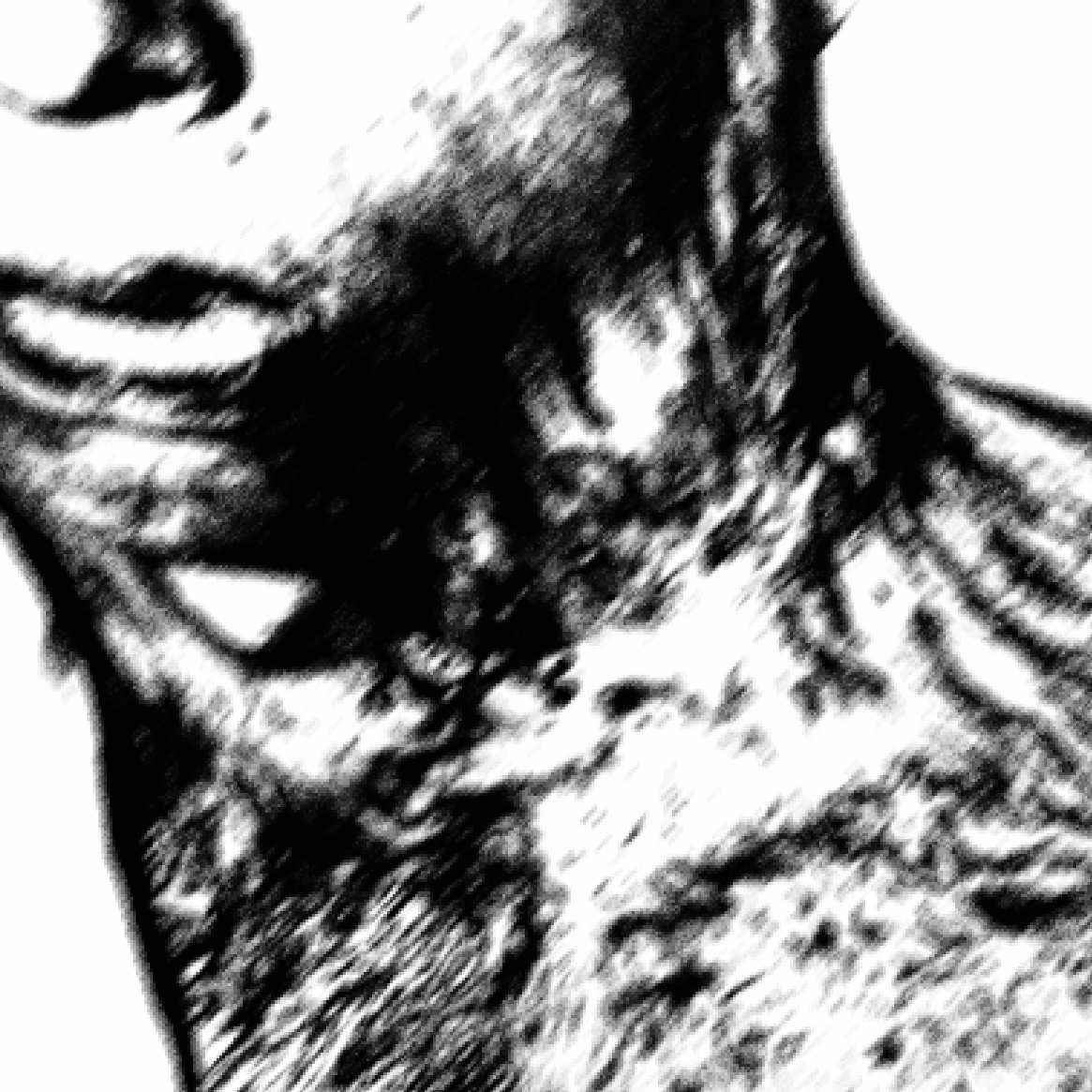 RSN - Detail